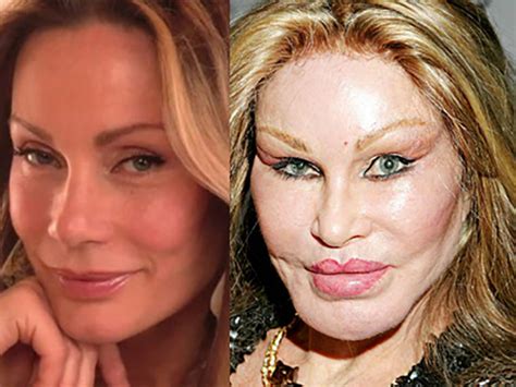 jocelyn wildenstein antes y despues